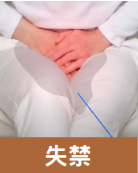 大小失禁
